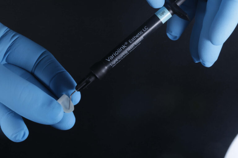 Imagen ilustrativa del artículo Adhesión dental inteligente