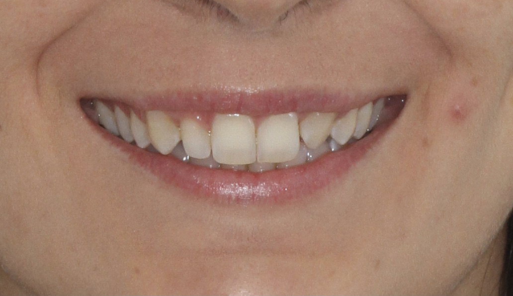 Estética simple y rápida — imagen 1
